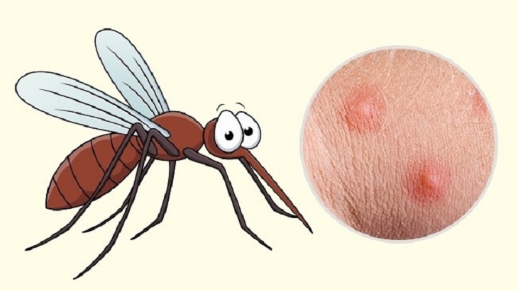Há Hốc Mồm” Khi Biết Lý Do Bạn Bị Muỗi Đốt Nhiều Hơn Người Khác